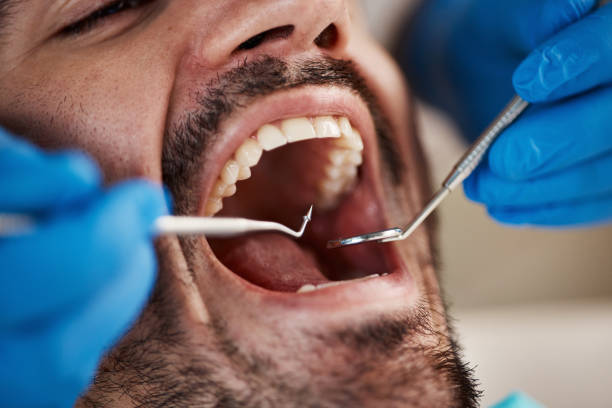 Best Emergency Dental Services for Seniors in Solvay, NY